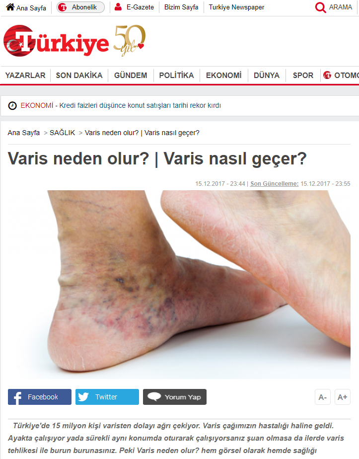 Varis neden olur? Varis nasıl geçer?